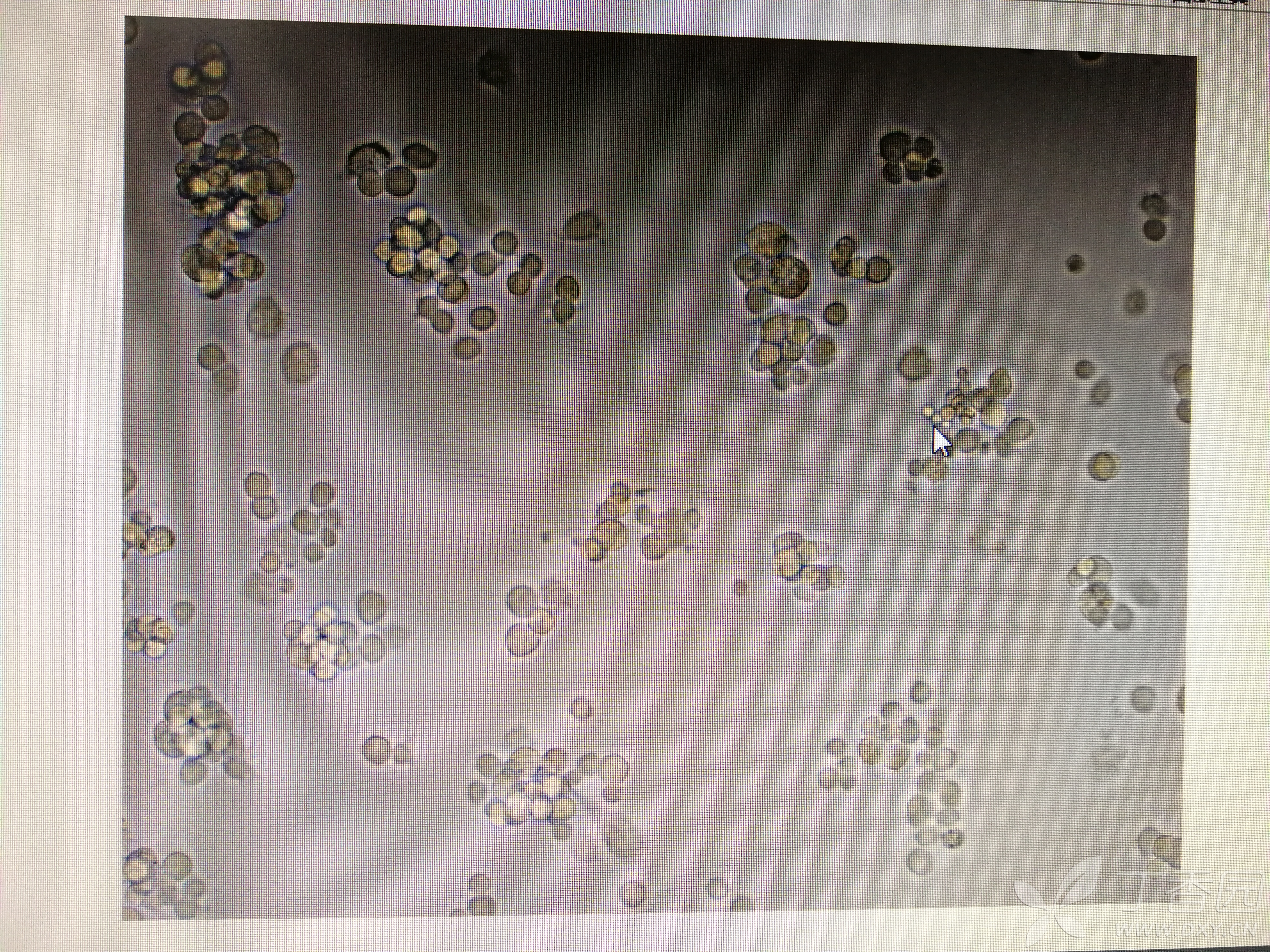 我的细胞也疑似被链球菌污染了.