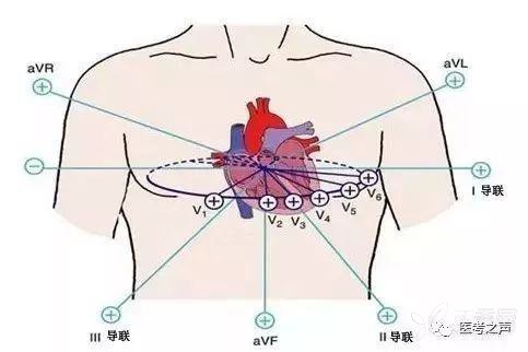 【原创】14种心电图,心电向量,电轴简单易懂!(word版 思维导图版)