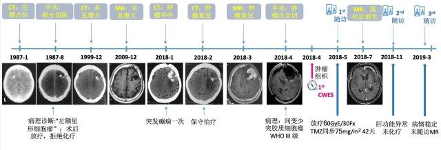 2018领星精准医疗案例大赛优秀案例展示二等奖cwes在胶质瘤的临床应用