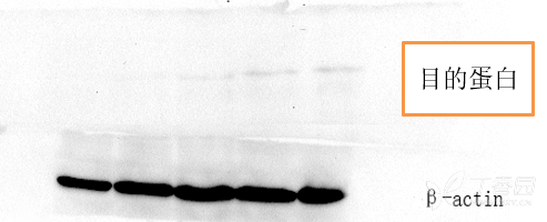 wb条带结果分析定量是怎么 一回事 蛋白质和糖学-丁香园论坛