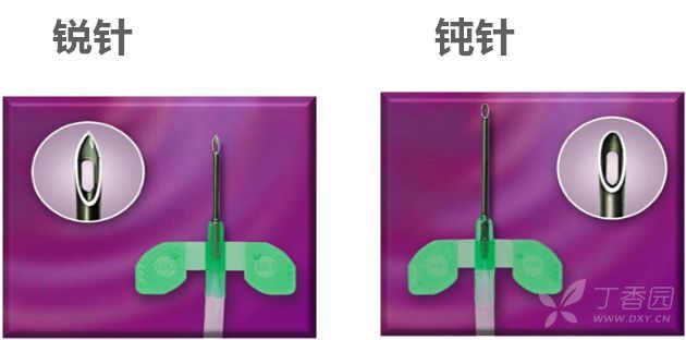 自体动静脉内瘘扣眼穿刺点的超声表现