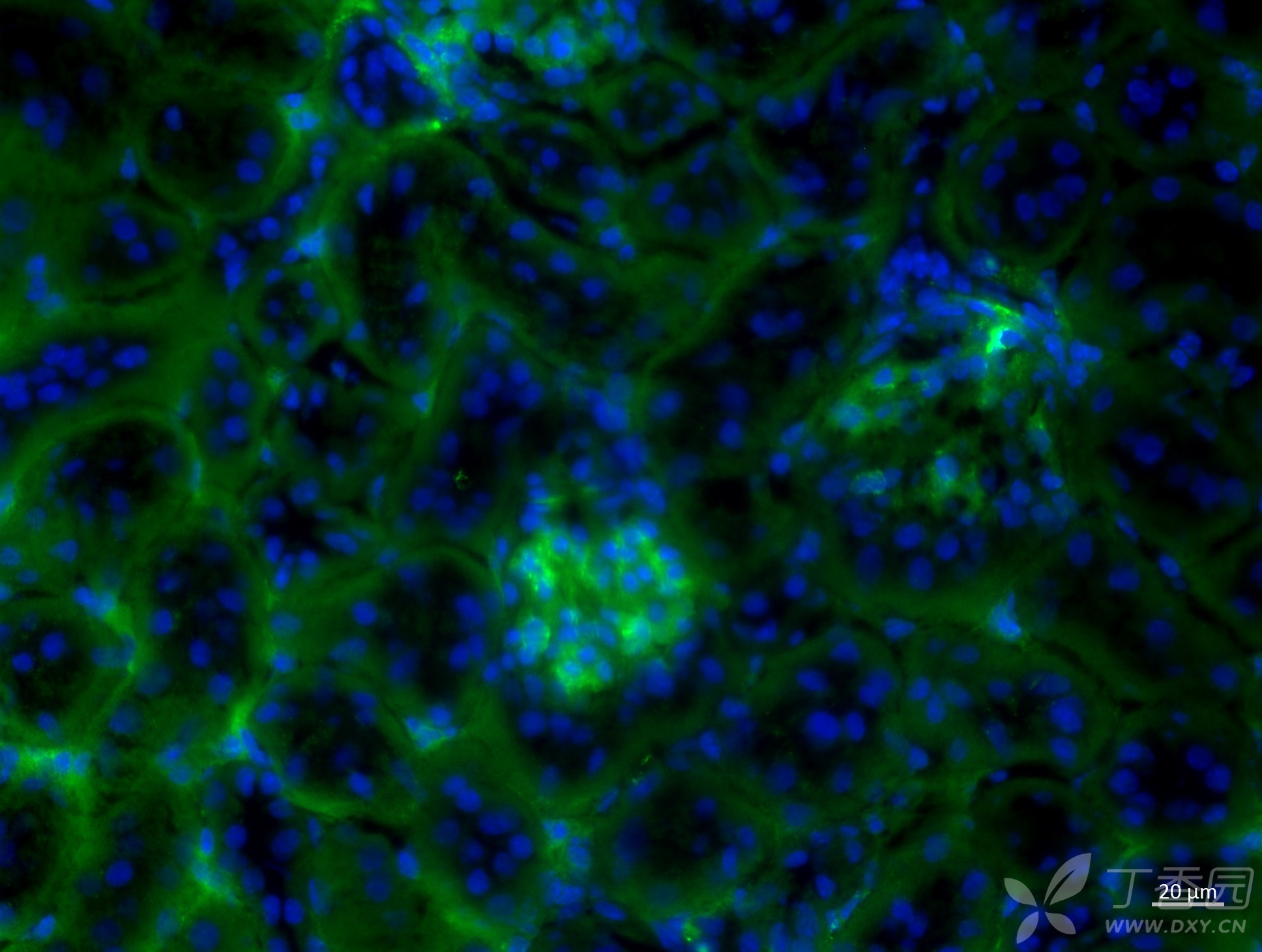 小鼠肾脏皮质免疫荧光,两种不同结构分别是什么?