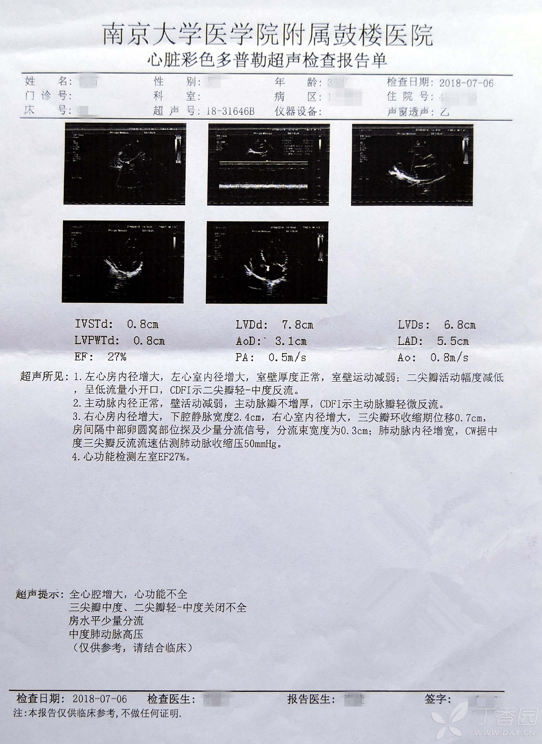 两张心脏彩超报告