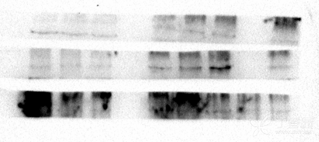 western blot条带背景问题与蛋白"手牵手"如何处理呢?