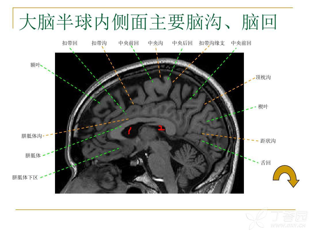 关于颅脑正中矢状断面断层解剖的问题