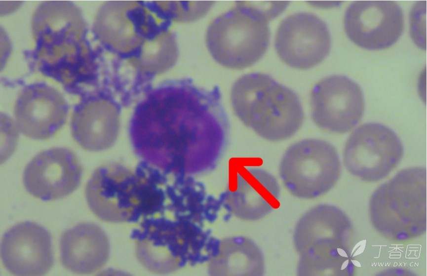 小鼠血涂片用瑞氏染色分类计数,但是看到的白细胞很少