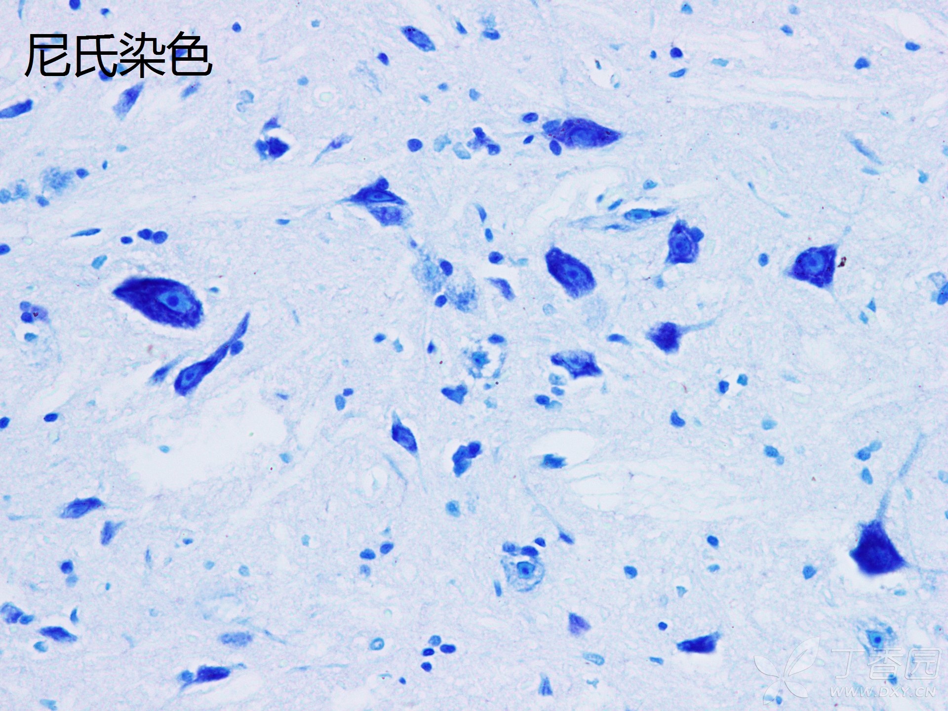 1%的甲苯胺蓝染液染色预热到60℃,切片入染液染色30min-60min,然后