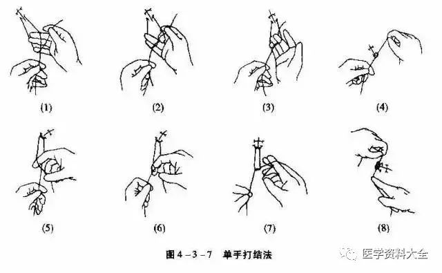 【超强总结】外科打结技能详解(图文并茂)