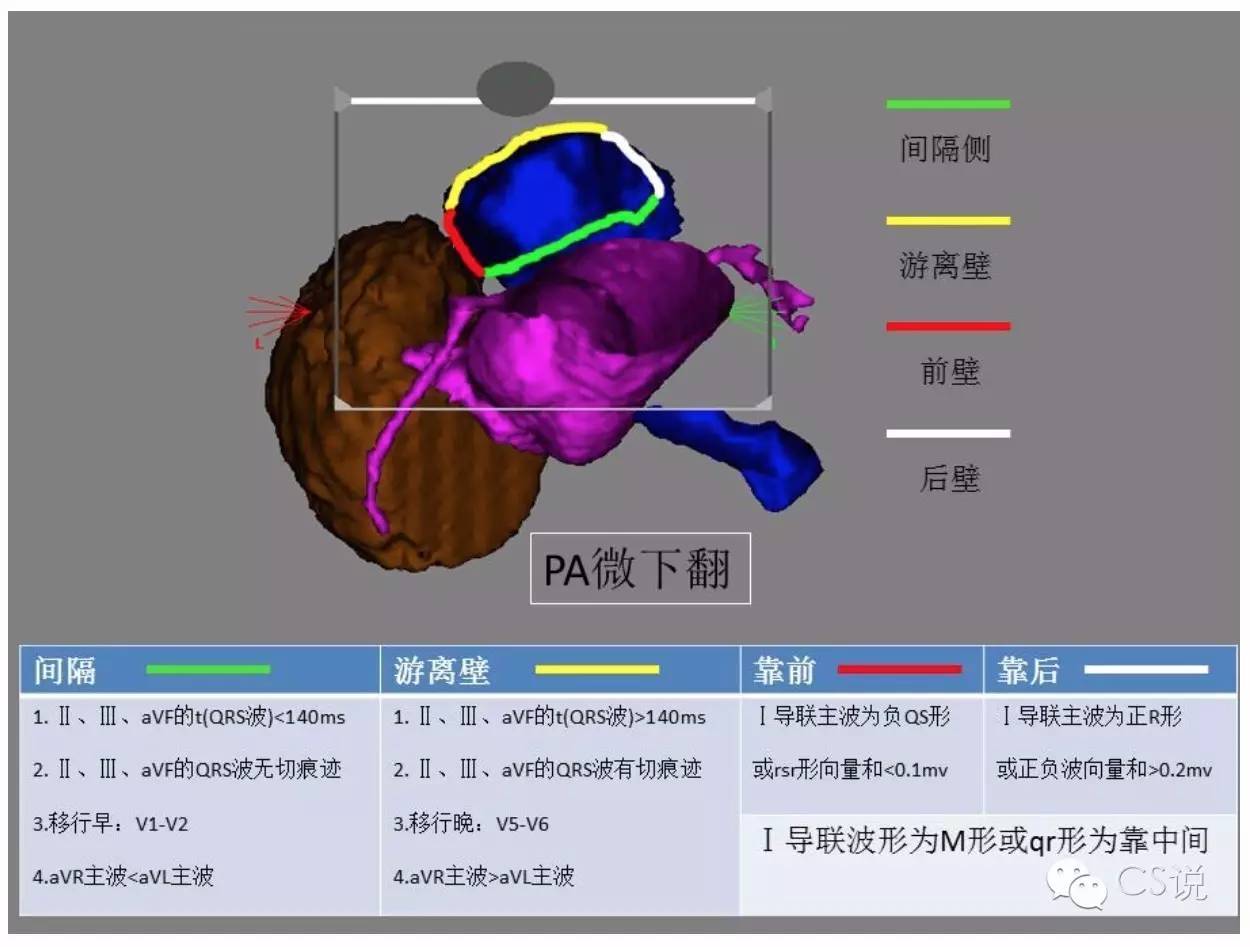 右室流出道室早定位总结(图文并茂)