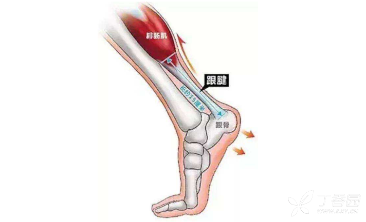 跟腱炎的症状及治疗方法