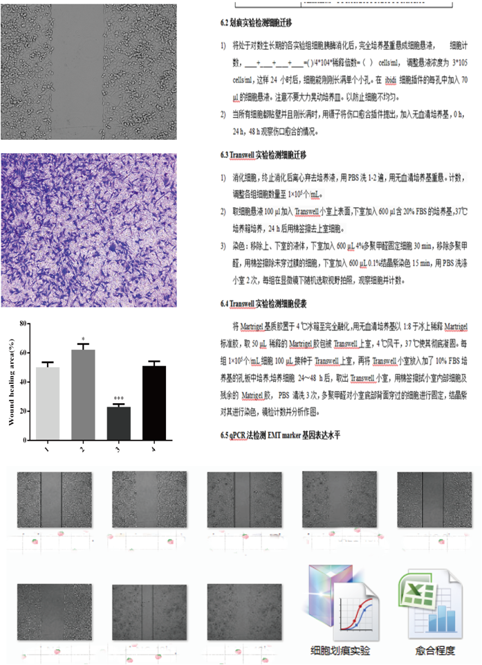 细胞迁移/细胞侵袭 (划痕愈合法,transwell法)