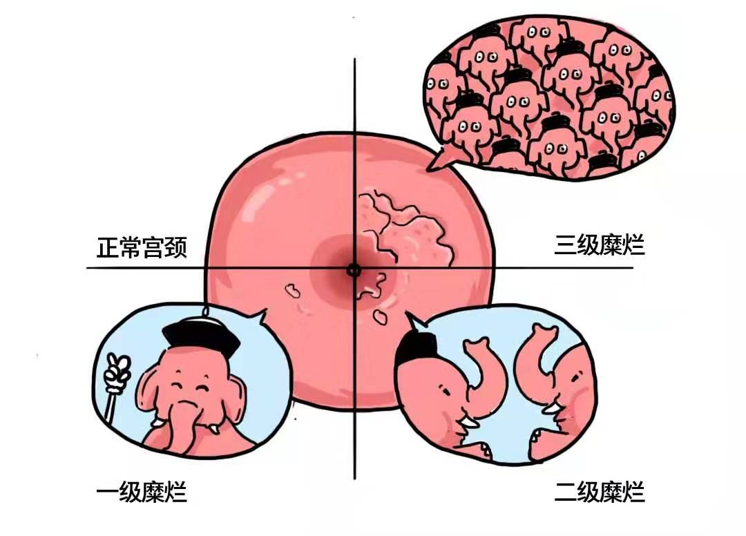 这种「手术」老外不做,中国女人却花钱买罪受