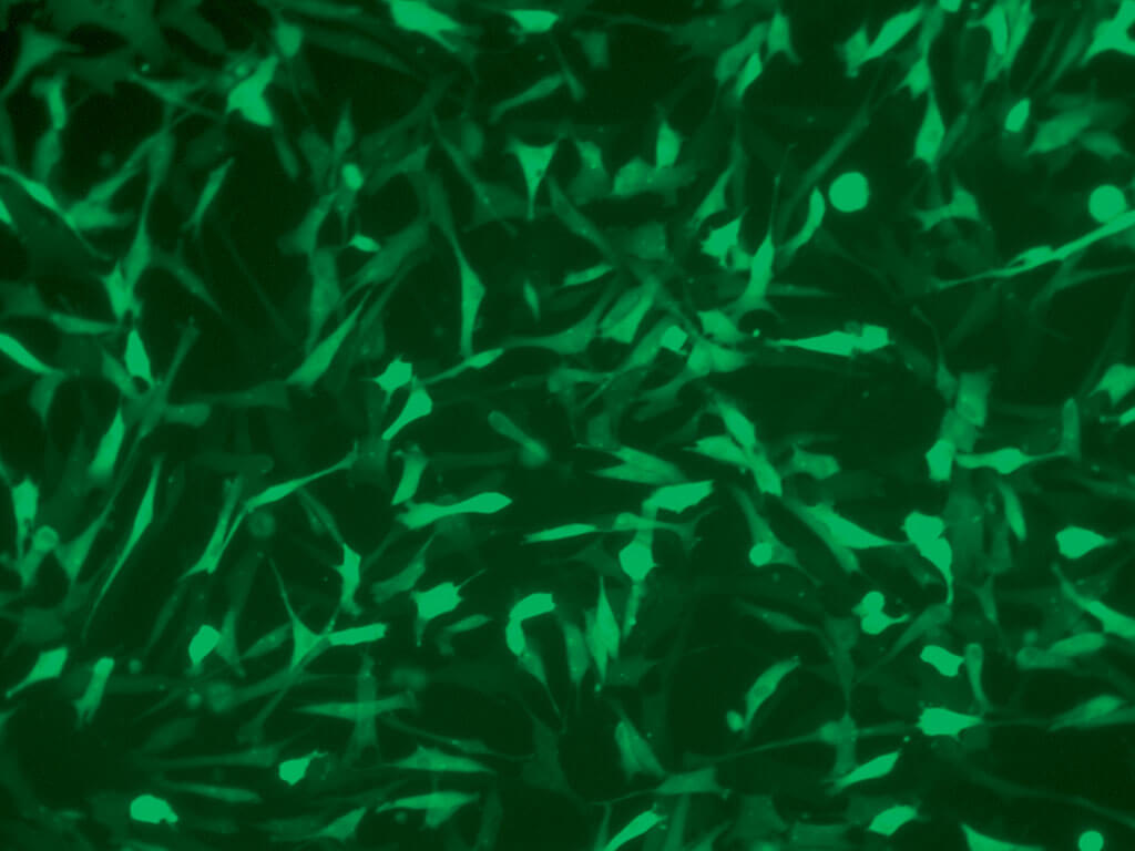 血管平滑肌细胞 LONZA人原代细胞中国一级代理商北京泽平