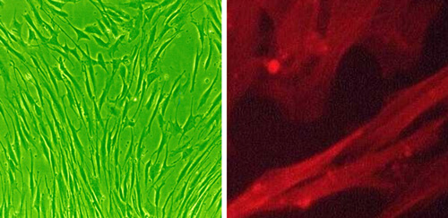 血管平滑肌细胞 LONZA人原代细胞中国一级代理商北京泽平