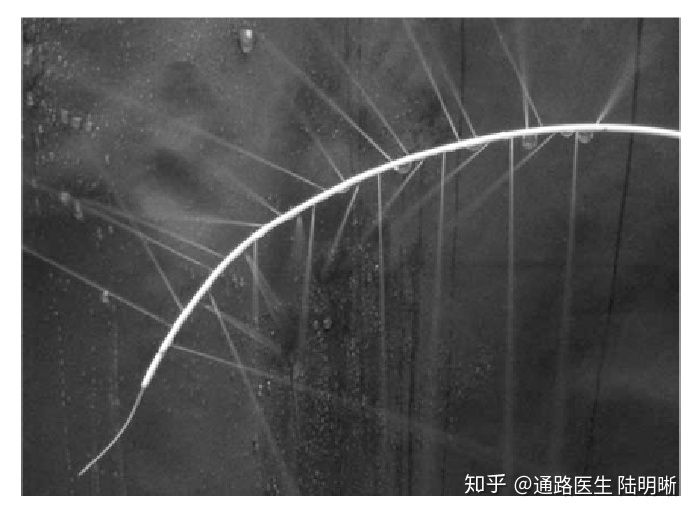 多侧孔溶栓导管