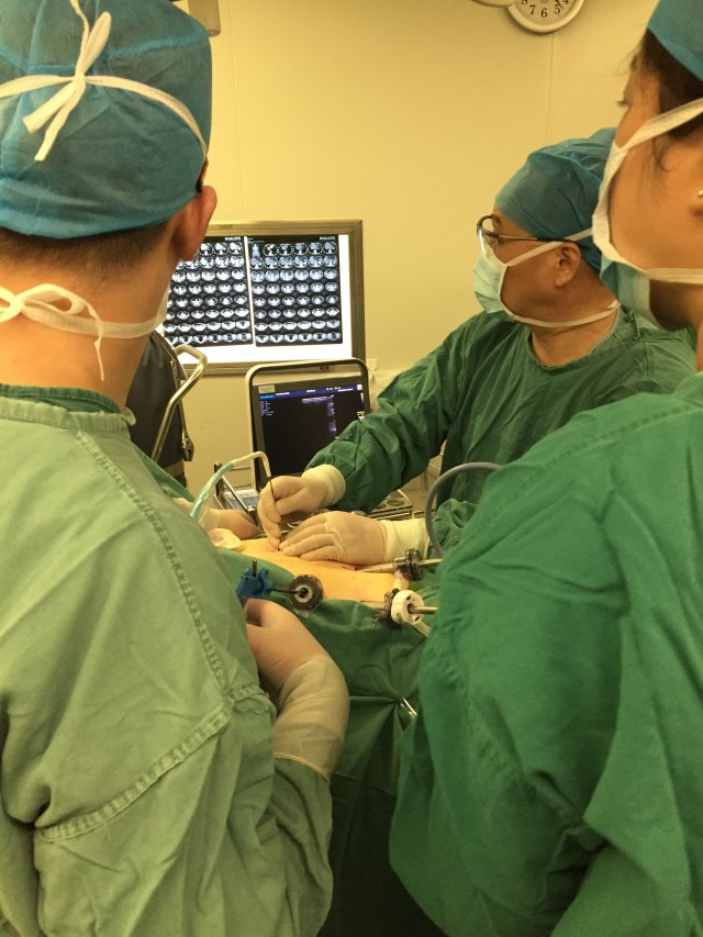 靶向刀胰腺癌冷冻消融临床效果及穿刺技巧