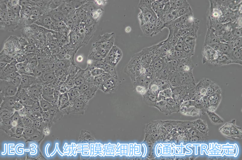 人绒毛膜癌细胞_价格-bv韦德体育app-厂家