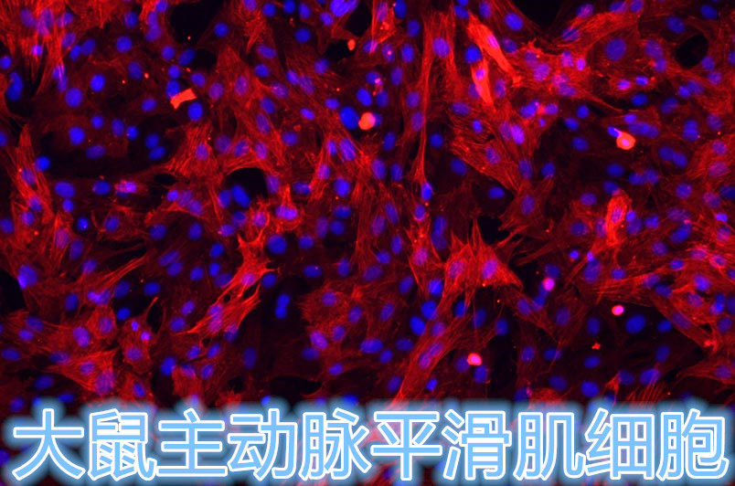 大鼠主动脉平滑肌细胞