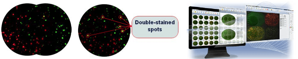 AID酶联免疫斑点分析仪 AID ELISPOT Reader AID中国一级代理商北京泽平