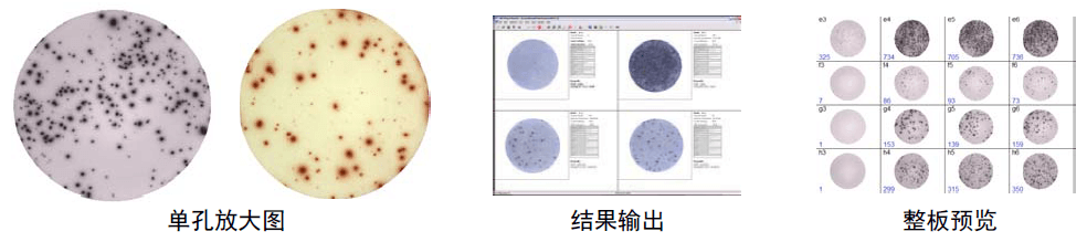 AID酶联免疫斑点分析仪 AID ELISPOT Reader AID中国一级代理商北京泽平