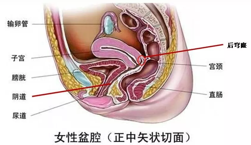 穹隆:宫颈是凸出到阴道,两者连接的地方相对显凹;又因为子宫在上方