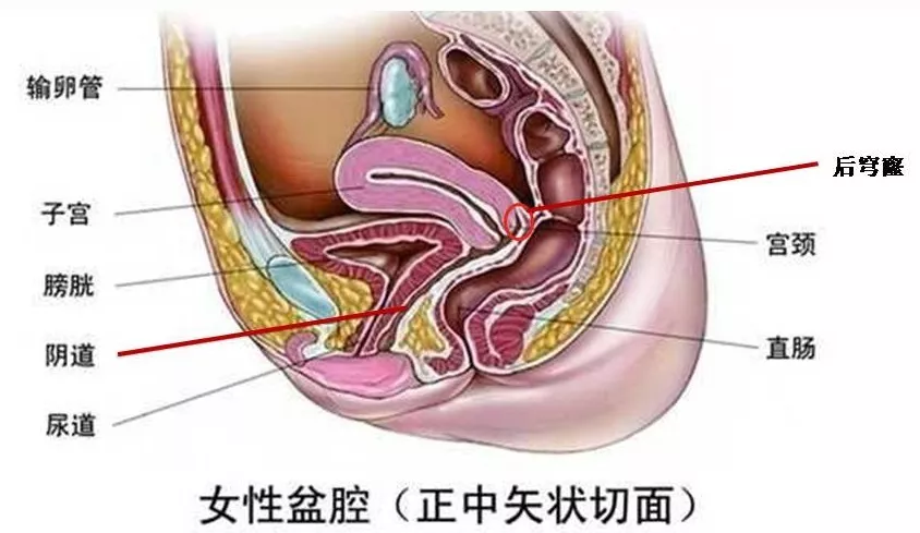 两者连接的地方相对显凹;又因为子宫在上方,就像抬头苍穹,故称为穹窿