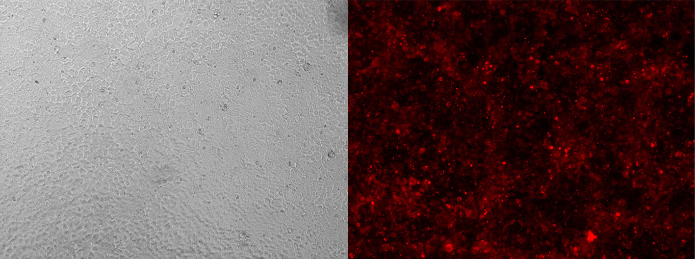 核糖核蛋白复合物RNP