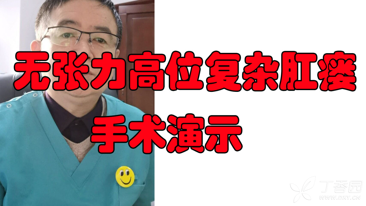 【原创】无张力高位肛瘘 马蹄形肛瘘手术根治视频下集