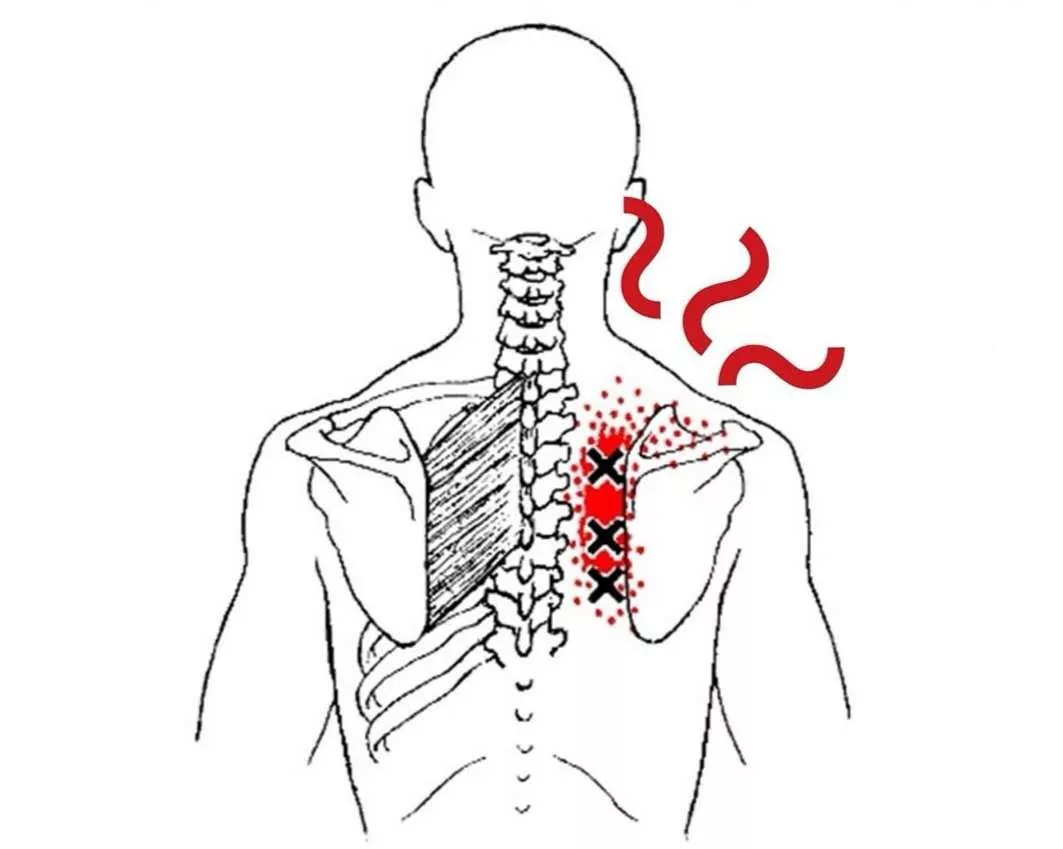 肋椎关节连接我们的肋骨和胸椎,具体分为肋头关节和肋横突关节,其中