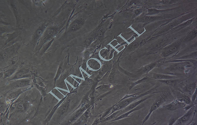 逸漠HFLS-RA 类风湿关节炎成纤维样滑膜细胞