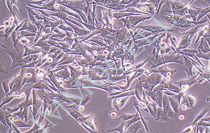 逸漠SK-MEL-5人皮肤恶性黑色素瘤