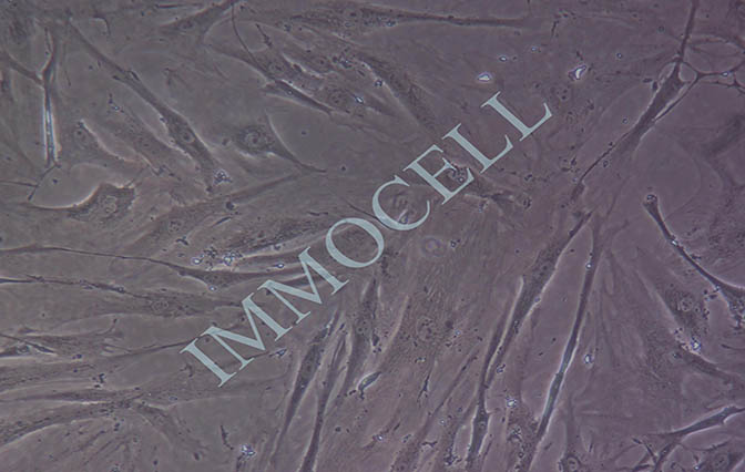 HFLS-RA 类风湿关节炎成纤维样滑膜细胞