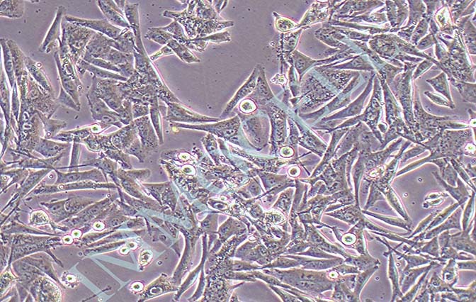 SK-MEL-5人皮肤恶性黑色素瘤