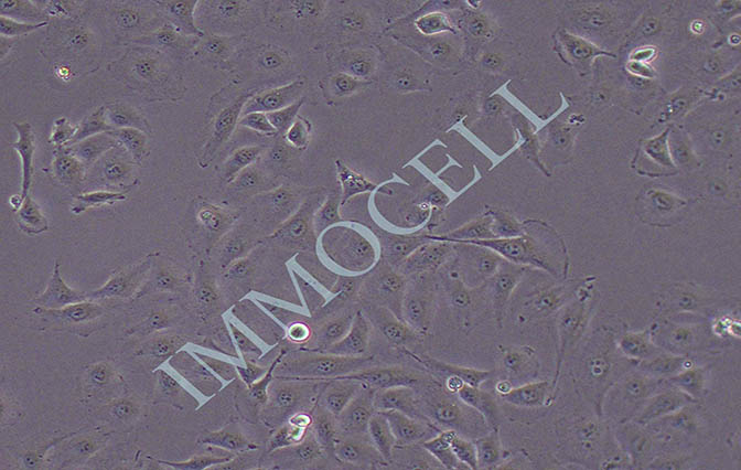 逸漠HUVEC 人脐静脉内皮细胞
