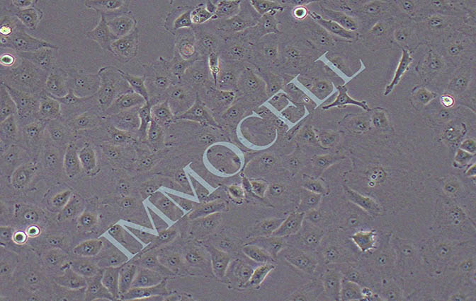 HUVEC 人脐静脉内皮细胞