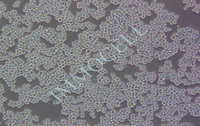 K562人慢性骨髓性白血病细胞系