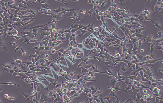 RD人横纹肌肉瘤细胞 