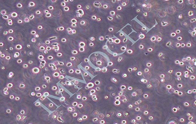 逸漠NK细胞白血病细胞