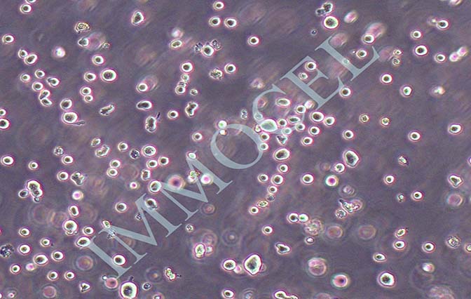 NK细胞白血病细胞