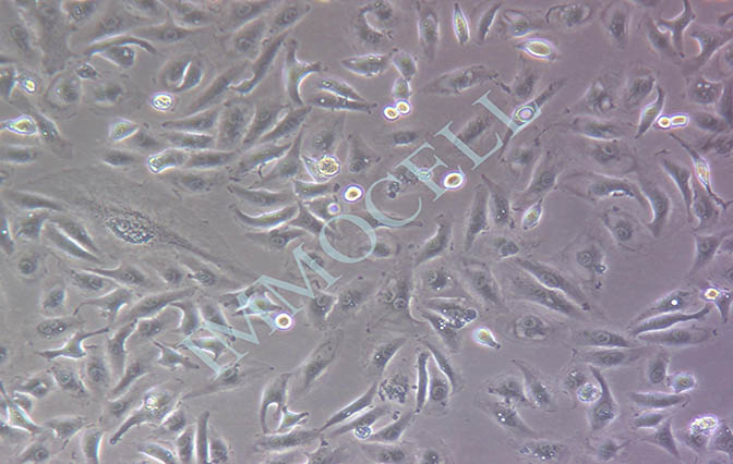 Caki-1人肾透明细胞癌皮肤转移细胞