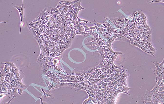 HCC827人非小细胞肺癌细胞
