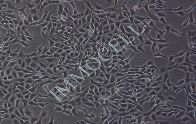 HGC-27人胃癌细胞