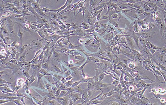 HRCEC人视网膜微血管内皮细胞