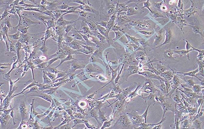 HRCEC人视网膜微血管内皮细胞