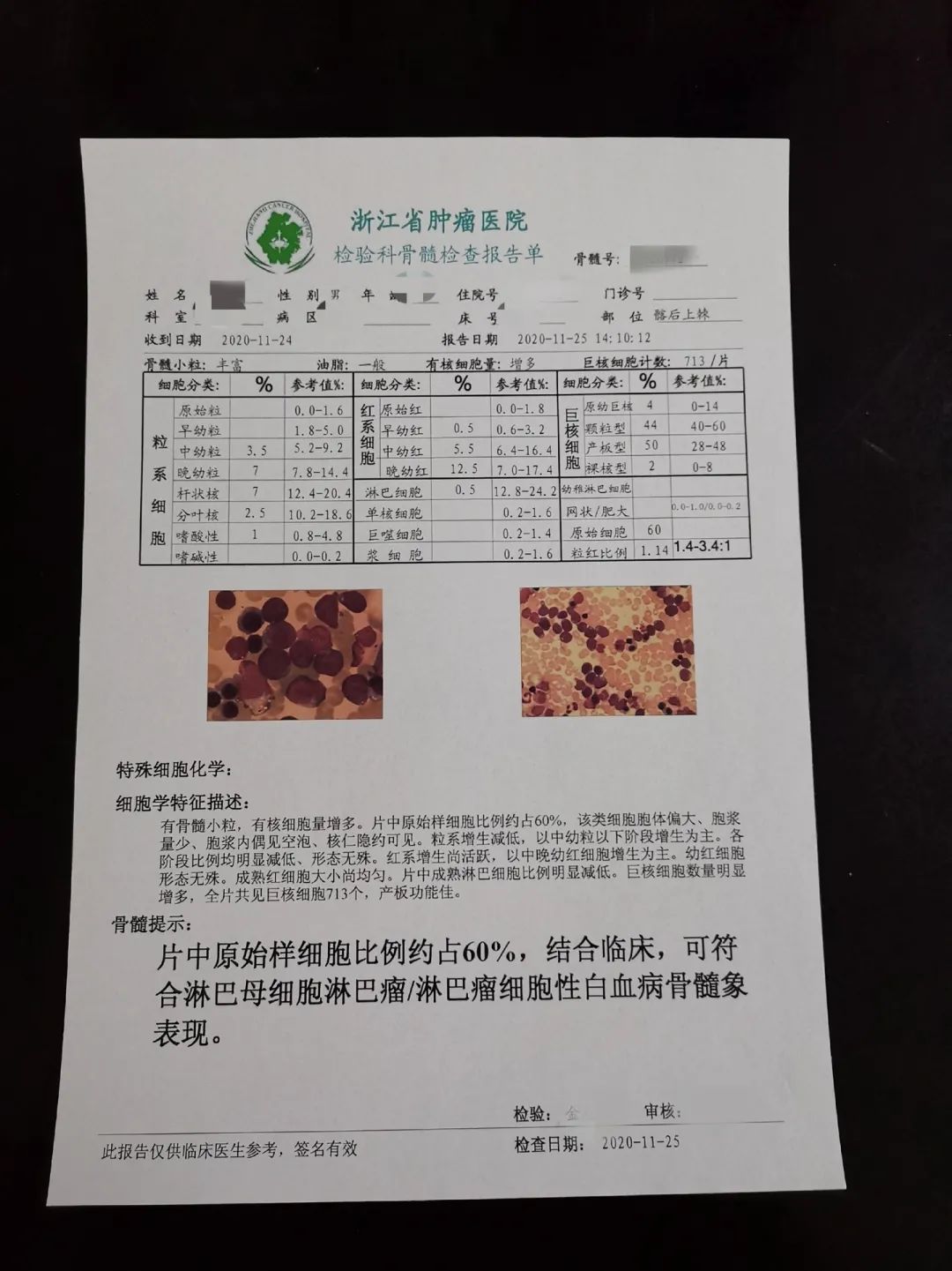 胸闷气急,全身乏力,竟然是得了急性白血病