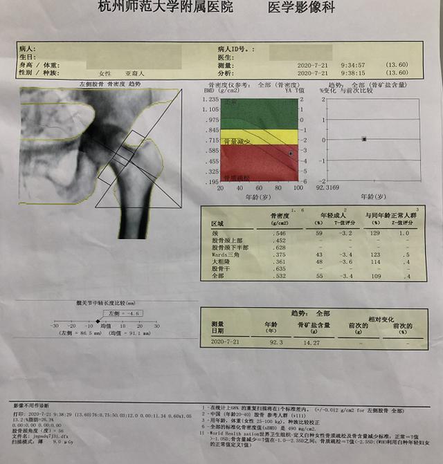 哪些人需要做骨密度检查如何读懂检查报告