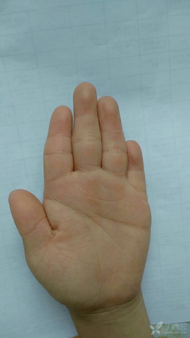 什么样的手掌最正常 3215845201097890310-16w.jpg!w640