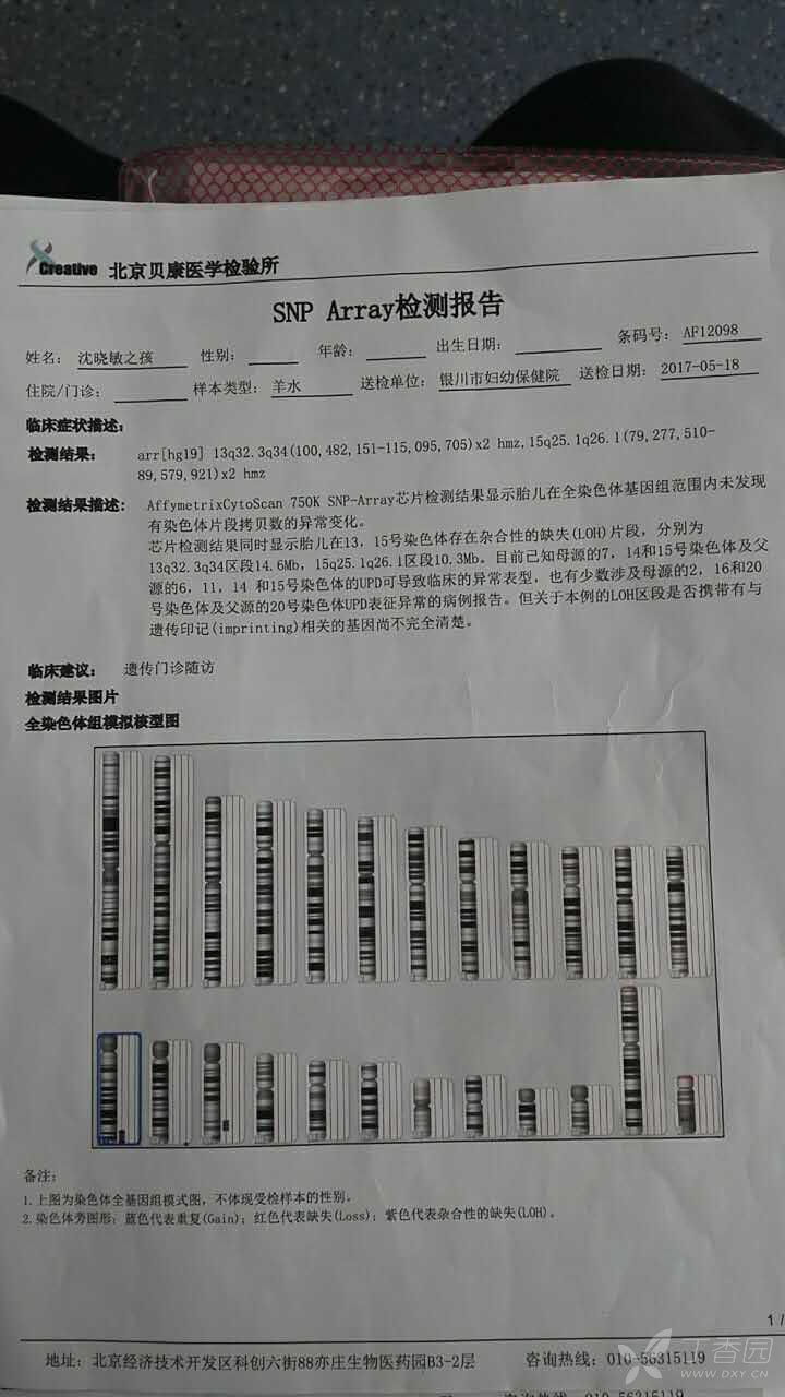 便捷!20号染色体基因片段重复要紧吗"如何孕育"-第1张图片-寻思网