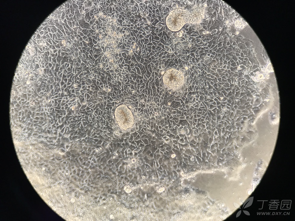 求大神鉴定caco2细胞污染,培养基有没有污染?