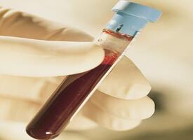 无菌脱纤维兔血